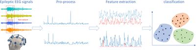 Minireview of Epilepsy Detection Techniques Based on Electroencephalogram Signals